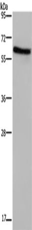 Anti-Human ART4 Antibody - ABMIUM