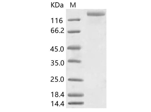 Recombinant HCoV-NL63 S1+S2 Protein (ECD, His Tag) - ABMIUM