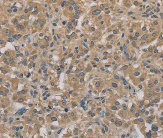 Anti-Human AGTRAP Antibody