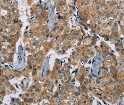 Anti-Human/Mouse PLXNA4 Antibody - ABMIUM