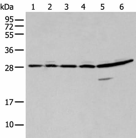 Western blot analysis of 293T A549 and Hela cell using SFN Polyclonal Antibody at dilution of 1:250