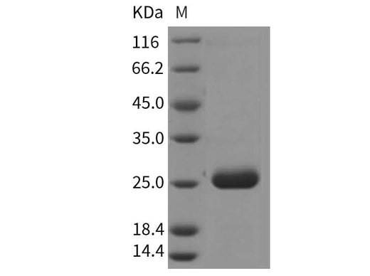 Recombinant Rat PRL2A1/Prolactin-2A1 Protein (His Tag) - ABMIUM