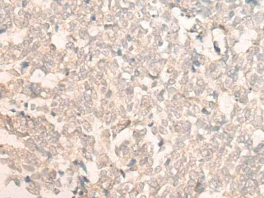 Anti-Human FAN1 Antibody - ABMIUM
