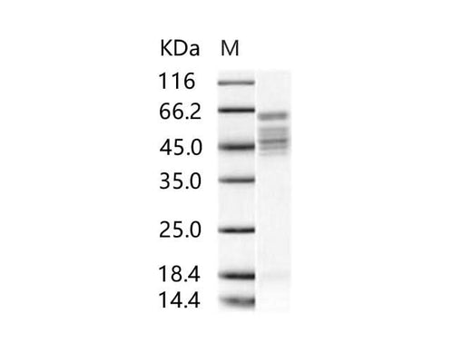 Recombinant RSV Fusion protein / RSV-F (Strain RSS-2) Protein (His Tag) - ABMIUM