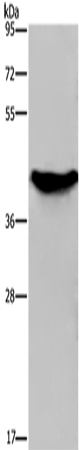 Anti-Human/Mouse GALK1 Antibody - ABMIUM