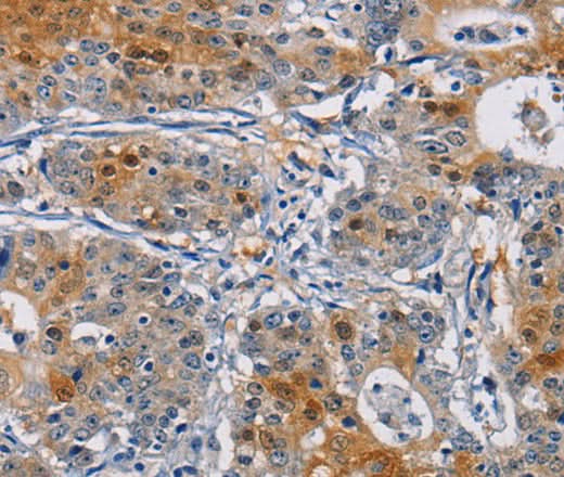 Anti-Human GSTA2 Antibody - ABMIUM
