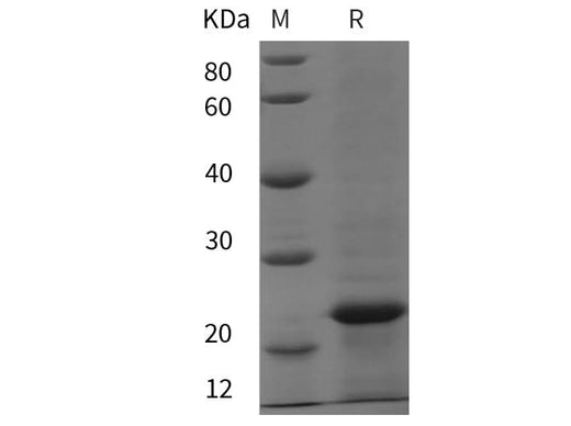 SDS-PAGE analysis of Rat MMP-12 proteins, 2 μg/lane of Recombinant Rat MMP-12 proteins was resolved with SDS-PAGE under reducing conditions, showing bands at 24 kDa.