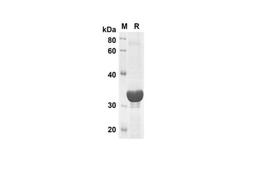 SDS-PAGE analysis of Human TNF-α proteins, 2 μg/lane of Recombinant Human TNF-α proteins was resolved with SDS-PAGE under reducing conditions, showing bands at 37.3 kDa.