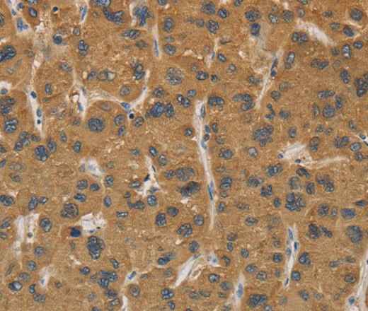Anti-Human CYP17A1 Antibody