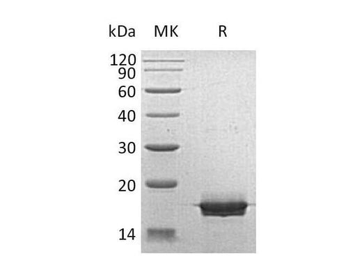 Recombinant Human MOG Protein (E.coli, His Tag) - ABMIUM