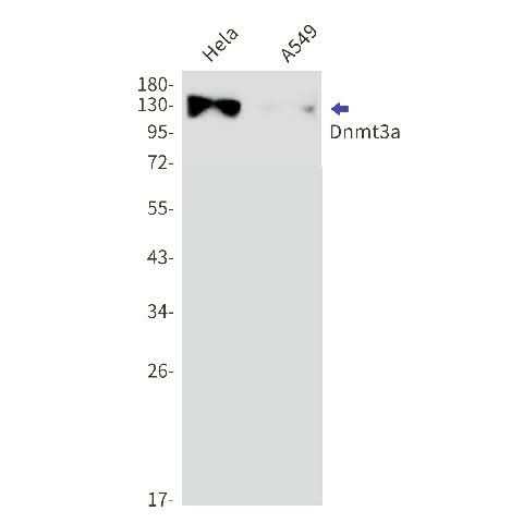 Western blot detection of Dnmt3a in Hela,A549 cell lysates using Dnmt3a Rabbit mAb(1:1000 diluted).Predicted band size:102kDa.Observed band size:130kDa.