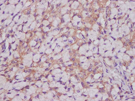 Anti-Human CEACAM-1/CD66a Antibody - ABMIUM