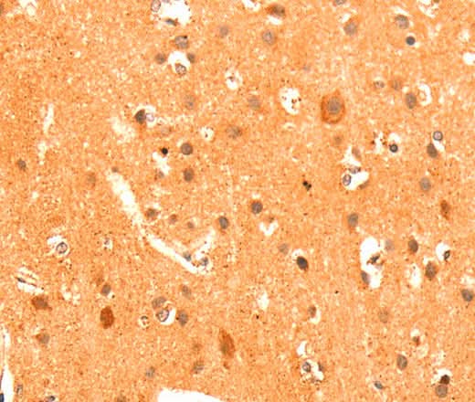 Anti-Human/Mouse/Rat GRM3 Antibody - ABMIUM