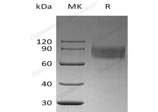 Recombinant Human IFNAR1/IFNAR Protein (His Tag) - ABMIUM