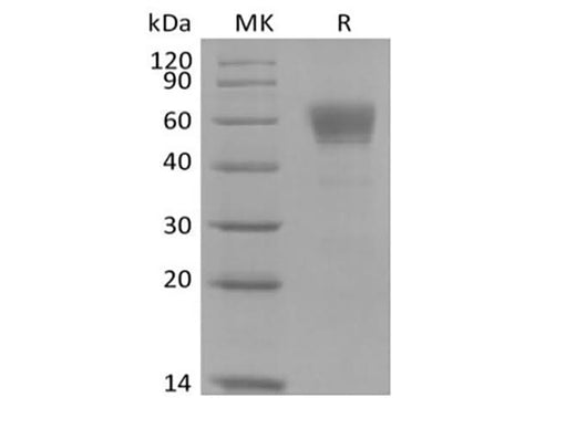 Recombinant Cynomolgus IL-3 Receptor Subunit Alpha/IL-3RA/CD123 (C-Fc) - ABMIUM