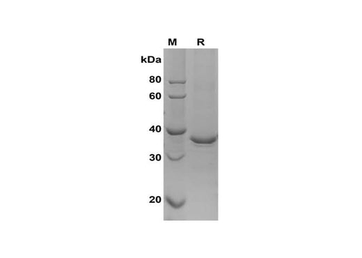 SDS-PAGE analysis of Mouse IL-17c proteins, 2 μg/lane of Recombinant Mouse IL-17c proteins was resolved with SDS-PAGE under reducing conditions, showing bands at 38 kDa.