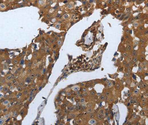 Anti-Human SLC34A2 Antibody