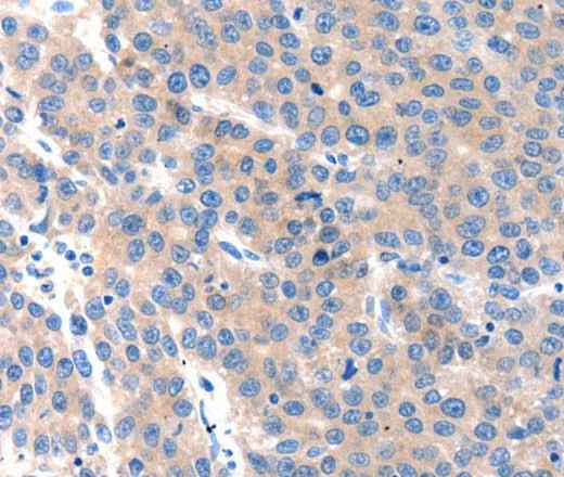 Anti-Human KLK2 Antibody