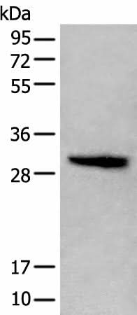 Western blot analysis of Jurkat cell lysate using HIST1H1C Polyclonal Antibody at dilution of 1:400