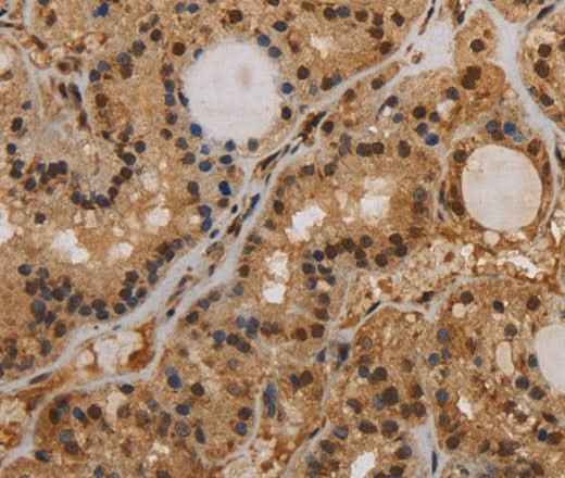 Anti-Human KCNN4 Antibody