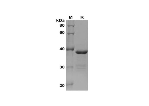SDS-PAGE analysis of Human ABCG2 proteins, 2 μg/lane of Recombinant Human ABCG2 proteins was resolved with SDS-PAGE under reducing conditions, showing bands at 38 kDa.
