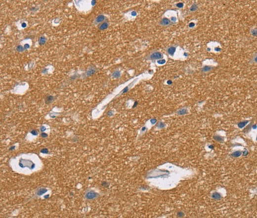 Anti-Human CD47 Antibody - ABMIUM