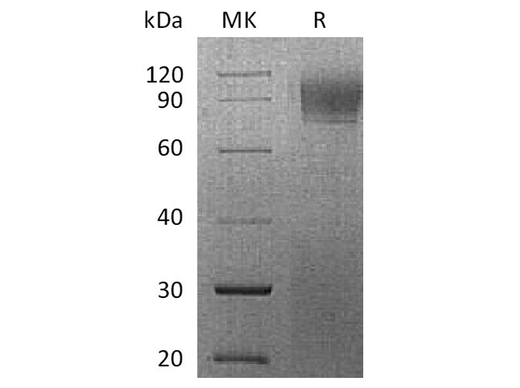 Recombinant Rhesus macaque IFNAR1 Protein (His Tag) - ABMIUM