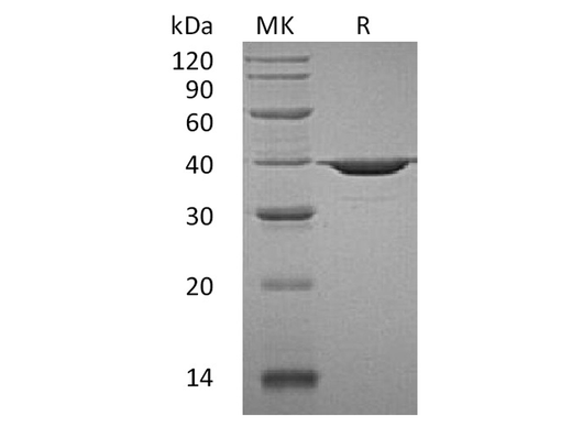 Recombinant Human APE1/APE Protein - ABMIUM