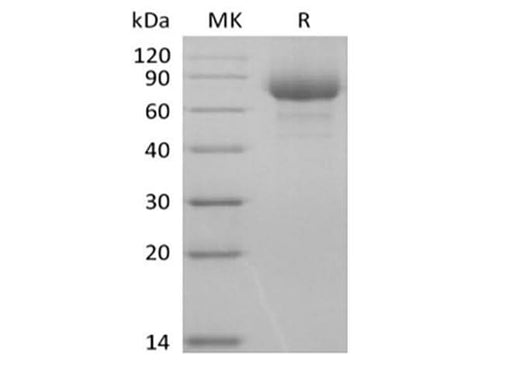 Recombinant Human Leukocyte Ig-Like Receptor A3/LILRA3/ILT6/CD85e (C-6His-Avi) Biotinylated - ABMIUM