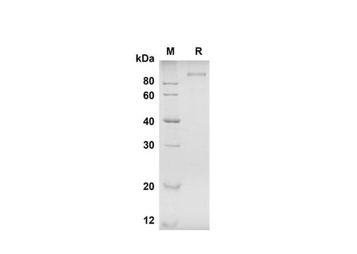 SDS-PAGE analysis of Human Tie-2 proteins , 2 μg/lane of Recombinant Human Tie-2 proteins was resolved with SDS-PAGE under reducing conditions , showing bands at 105 kDa.