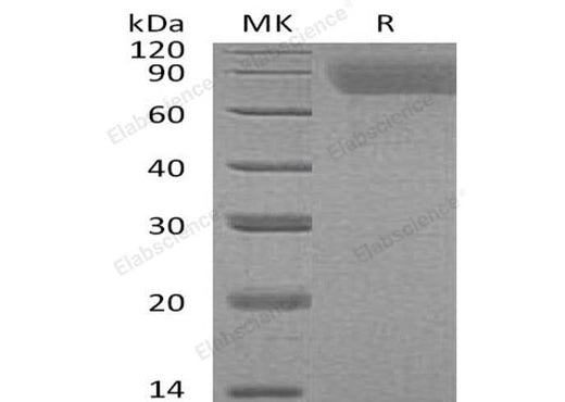 Recombinant Human Thrombopoietin/TPO Protein (His Tag) - ABMIUM