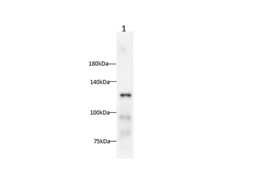 Anti-Human E-Cadherin Antibody - ABMIUM