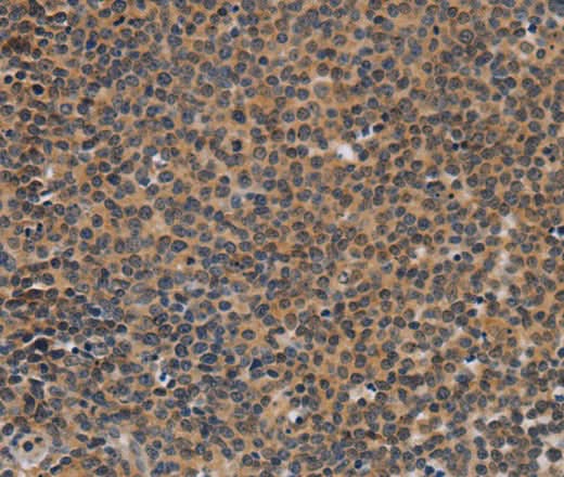 Anti-Human TNFRSF8 Antibody - ABMIUM