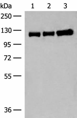 Western blot analysis of Human cerebella tissue Human cerebrum tissue and Human fetal brain tissue lysates using GRIK3 Polyclonal Antibody at dilution of 1:400