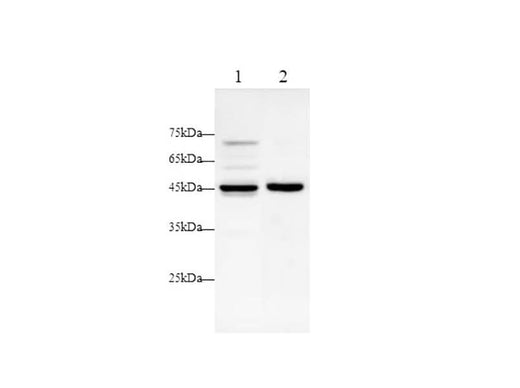 Anti-Human Angptl4 Antibody - ABMIUM
