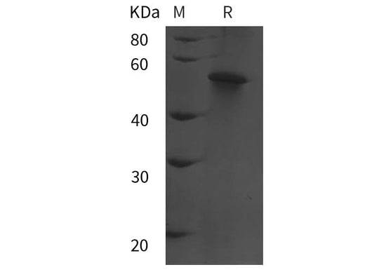 SDS-PAGE analysis of Human STEAP3 proteins, 2 μg/lane of Recombinant Human STEAP3 proteins was resolved with SDS-PAGE under reducing conditions, showing bands at 55 kDa.