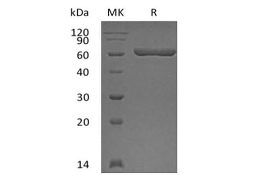 Recombinant Human Galectin-9/LGALS9 (N-GST) - ABMIUM