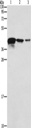 Anti-Human/Mouse TWF2 Antibody - ABMIUM