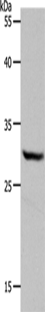 Anti-Human/Mouse/Rat NQO1 Antibody - ABMIUM