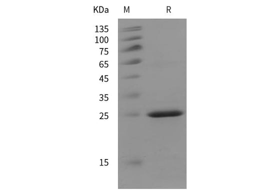 SDS-PAGE analysis of Mouse MUC16 proteins, 2 μg/lane of Recombinant Mouse MUC16 proteins was resolved with SDS-PAGE under reducing conditions, showing bands at 25 kDa.