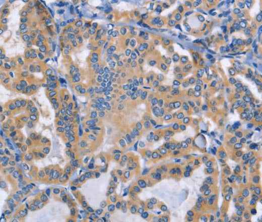 Anti-Human/Mouse DOK4 Antibody