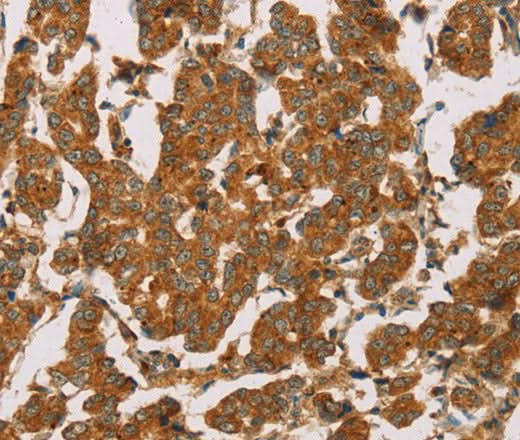 Anti-Human/Mouse DLL4 Antibody - ABMIUM