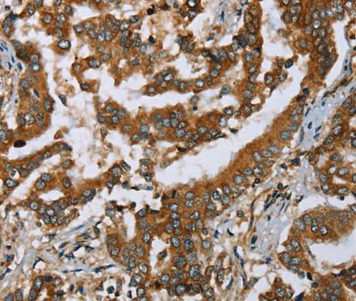 Anti-Human/Mouse PLXNB1 Antibody - ABMIUM