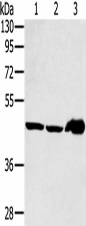 Anti-Human/Mouse SEC14L2 Antibody - ABMIUM