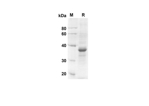 SDS-PAGE analysis of Human CCL3 proteins, 2 μg/lane of Recombinant Human CCL3 proteins was resolved with an SDS-PAGE under reducing conditions, showing bands at 32.1 kDa.