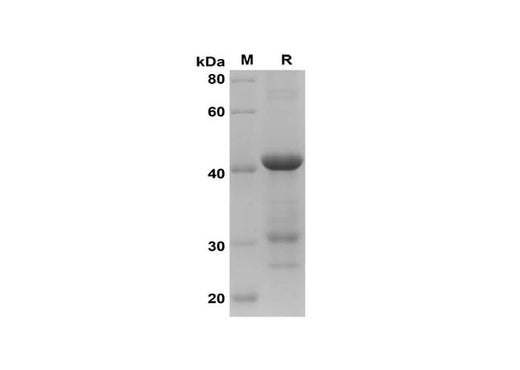 SDS-PAGE analysis of Rat IL-2 proteins, 2 μg/lane of Recombinant Rat IL-2 proteins was resolved with SDS-PAGE under reducing conditions, showing bands at 42 kDa.