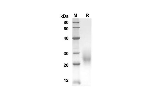 SDS-PAGE analysis of Mouse Ctla4 Cd152 proteins, 2 μg/lane of Recombinant Mouse Ctla4 Cd152 proteins was resolved with an SDS-PAGE under reducing conditions, showing bands at 13.8 kDa.