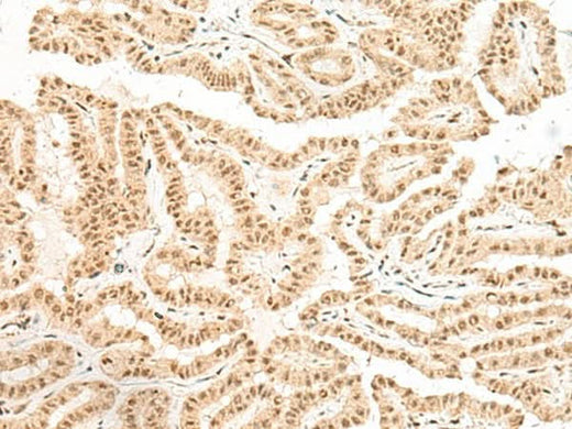 Anti-Human BICRA Antibody - ABMIUM