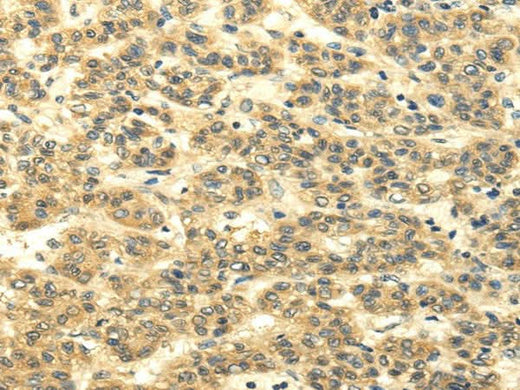 Anti-Human/Mouse/Rat MSI1 Antibody - ABMIUM