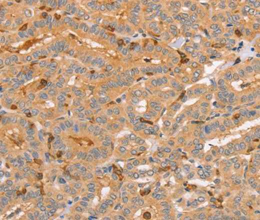 Anti-Human CCL16 Antibody